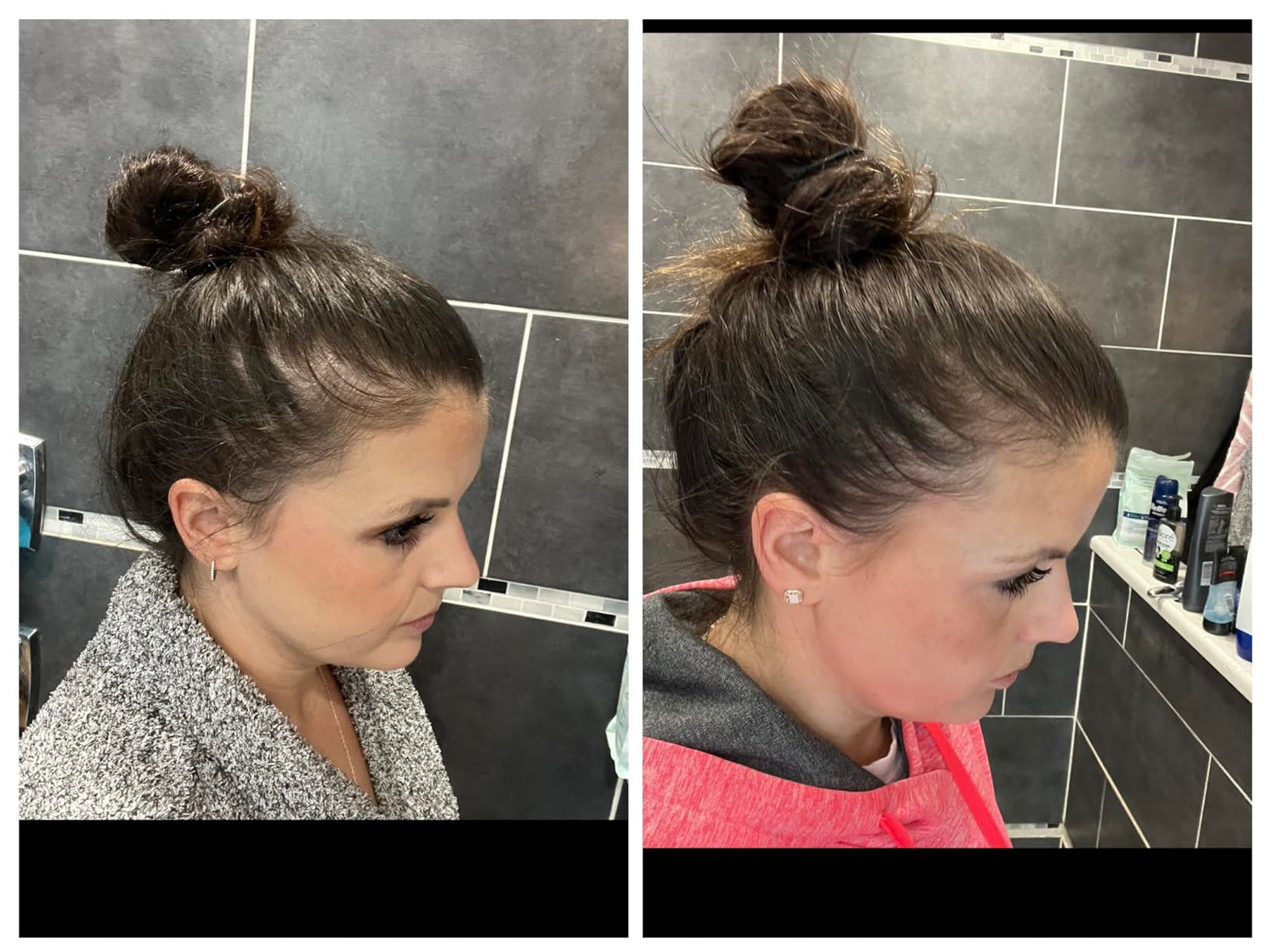 Tónico Crecimiento Capilar + Shampoo Anti-Caída + Obsequios